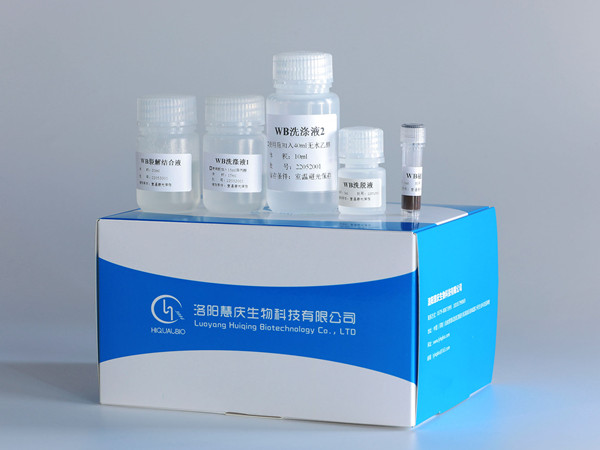 病毒DNA提取不合格的原因和处理方法